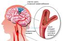 Тромбы в сердце и коронарных артериях